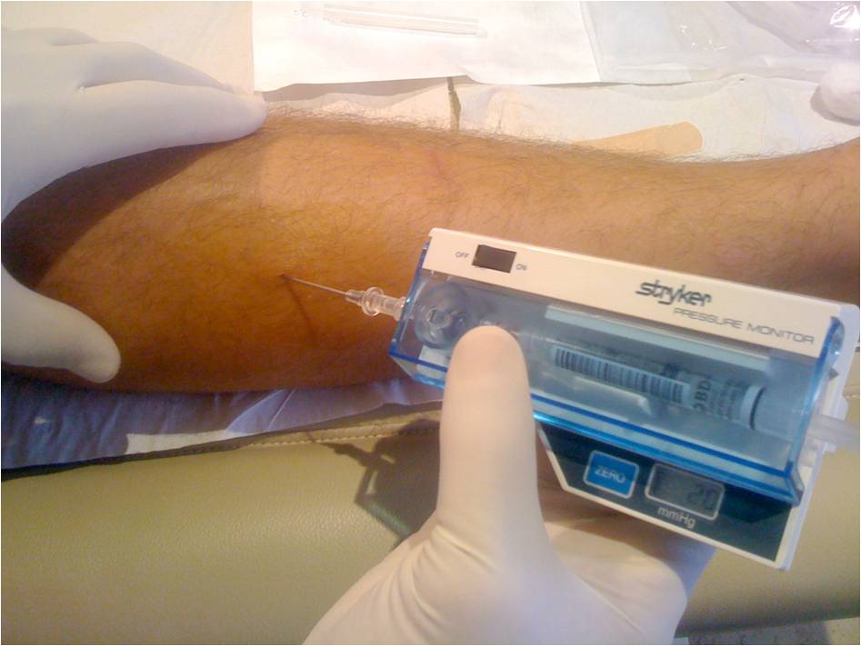 Une douleur de la jambe à diagnostiquer en urgence – Centre de ...